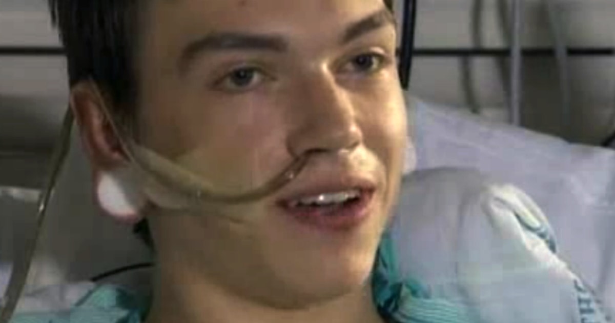 Teen on the mend after eating grill brush bristle